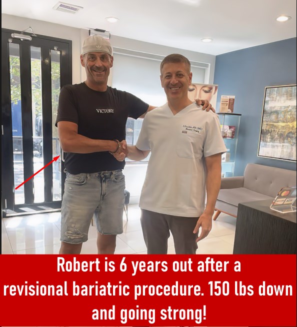 Before And After Revisonal Bariatric Procedure - 150 LBS Down